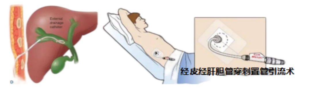 174234ie0memd907pzp4im.png