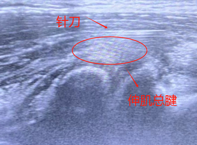 093701ri1qc7x1kkcc7k13.png